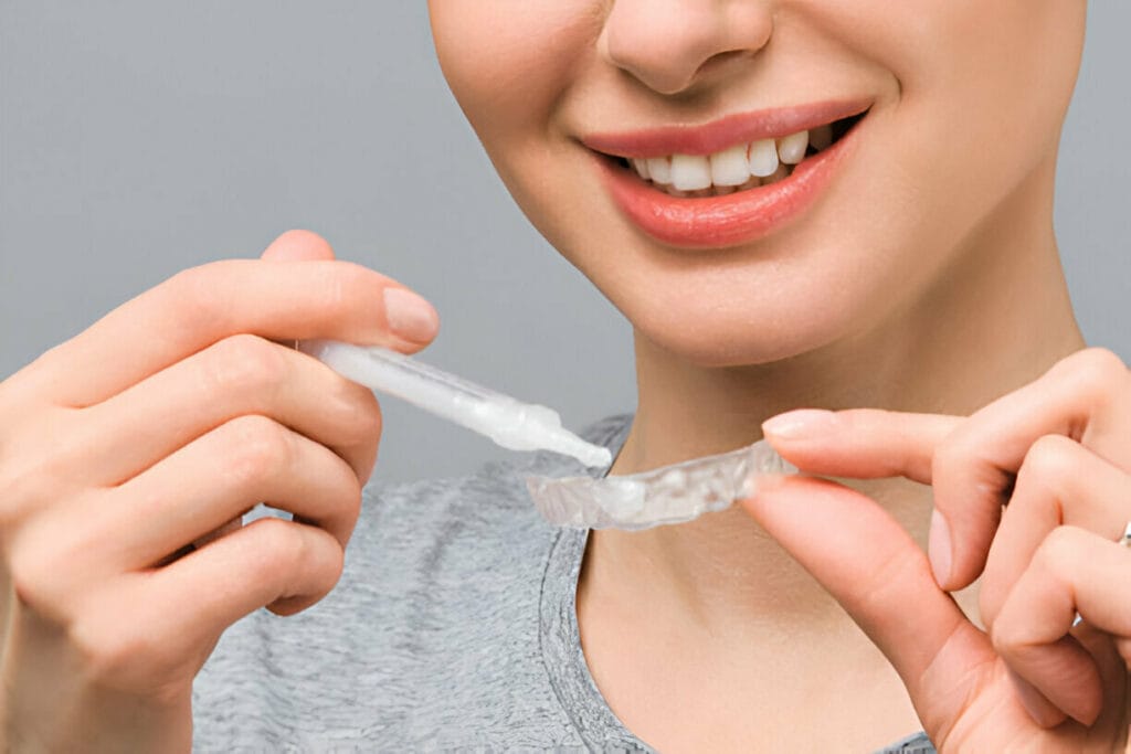 A woman applying whitening gel to a clear dental tray, smiling and showing her white teeth.